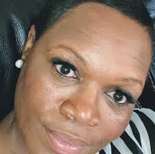 Many scammers in this group that were taking my post. Just got back from ER  and this is where I am at. Still very high just lower than yesterday. Thank  you 1000x