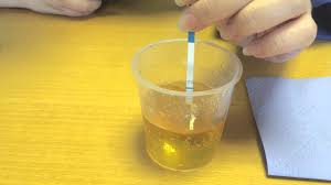 Pregnancy test strips in urdu. Pregnancy Test Pest Strip In Urdu Noorclinic In Buy Products In Ante Health May 09 2020