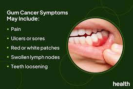 Image result for cancer tongue symptoms)