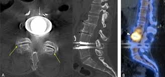 Image result for Low Back Imaging
