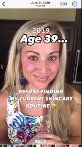 Pomifera Rose Vs Pure Mandy Simms