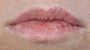 Bibir kering antara salah satu masalah yang boleh mengganggu tahap penampilan diri kaum ini tipnya elak bibir kering. Kenapa Bibir Kering Archives Precious Droplets