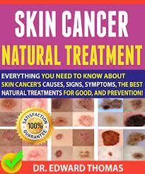Cases of skin cancer have been on the. Skin Cancer Natural Treatment Everything You Need To Know About Skin Cancer S Causes Signs Symptoms The Best Natural Treatments For Good And Prevention By Dr Edward Thomas