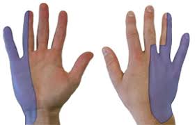 Cubital Tunnel Syndrome Hand Orthobullets