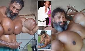 Brazilian Bodybuilder Risks His Life By Injecting Himself With Oil To Boost His Biceps To 23 Inches Daily Mail Online Frequent special offers and discounts up to 70% off for all products! brazilian bodybuilder risks his life by