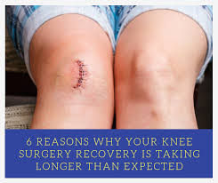 6 Reasons Why Your Knee Surgery Recovery Time Is Taking Longer Knee Replacement Recovery Knee Surgery Recovery Knee Replacement Surgery Recovery