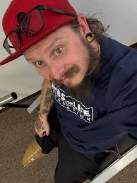 Urgent blood donation needed for leg amputation surgery