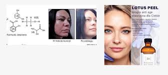 Peeling Medyczny Rhonda Allison