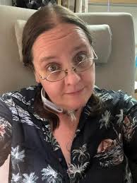 Solo Home Hemodialysis Treatment Issues and Frustrations