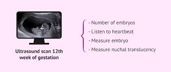 Image result for First Trimester Ultrasound