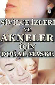 En Iyi Sivilce Maskesi Ve Sivilce Giderici Maske Tarifi Cilt Bakimi Sivilce Izi Cilt Bakimi Cilt Bakimi Tuyolari