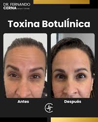 🌟 Soy el Dr. Fernando Cerna y quiero contarte sobre un protocolo que está  transformando pieles: Hydroxifil + Infini L + Infini NHA. ¿Para qué sirve  esta combinación? ✨ Hidrata profundamente desde