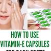 Vitamin e supplement benefits for skin. Https Encrypted Tbn0 Gstatic Com Images Q Tbn And9gcslk Tma776quelheixfmb1rqpnizxz6z1zmqdlt0a Usqp Cau