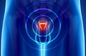 Many men with prostate cancer die of other causes without ever knowing that they others are aggressive and grow and spread quickly. Better Treatment For Aggressive Prostate Cancer Ecancer