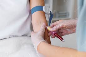 IgE Allergy Test: Purpose, Procedure And Interpretation | Metropolis  TruHealth Blog