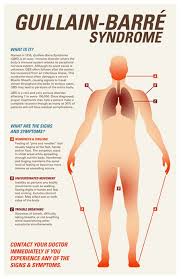 Weakness and tingling in your extremities are usually the first symptoms. Pin On Medicina Salud
