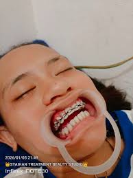 Cuman di @tamaya.eyelashes.bdg loh bisa homeservice tanpa booking tanpa DP  alias dadakan shayy💖 (dengan syarat slot sedang kosong) Dengan harga promo  kualitas premium,yang terpenting ongkirnya murah SE-BANDUNG RAYA dan bisa  keluar kota