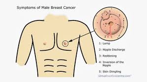 Use light, medium, and firm pressure. Male Breast Cancer The Disease No One S Talking About