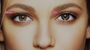 The lenses are steam sterilized. 1 800 Contacts Connect Introducing Air Optix Colors