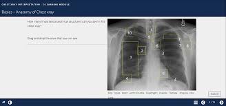 Common symptoms that can be diagnosed using chest. Teaching Medical Students How To Interpret Chest X Rays The Design An Amep