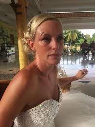 Couple left distraught after dream £25,000 Cuba wedding turns to disaster  when hotel roof COLLAPSED leaving bride permanently scarred and groom with  broken ribs