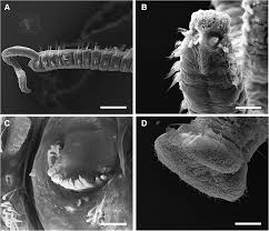 It's important to know what infestations are actually horrible enough to require immediate action. 6i Aos5whakdxm