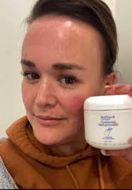 Has anyone experienced acne breakouts after using the Detox Mask?