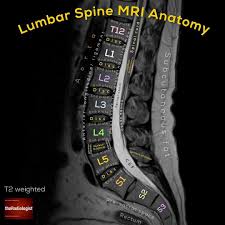 To get started finding mri foot muscle anatomy , you are right to find our website which has a comprehensive collection of manuals listed. Sagittal T2 Weighted Image Of An Mri Of The Lumbar Spine Lumbar Spine Mri Anatomy This Is A Commonly Performed Anatomy Radiology Radiology Student