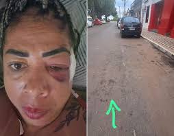 Mulher sofre fraturas no rosto ao ser atropelada em festa da vit&oacute;ria Lula | HiperNot&iacute;cias - Voc&ecirc; bem informado