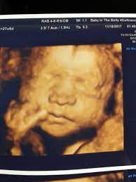 Check spelling or type a new query. 27 Week 4d Ultrasound February 2018 Babies Forums What To Expect