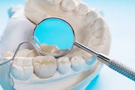 Gigi palsu permanen yang berikutnya adalah bridge, gigi tiruan permanen bridge biasanya digunakan untuk menggantikan gigi asli yang hilang lebih dari satu. Promo Besar Besaran Dental Crown Selalu Belanja Dengan Harga Terbaik 2021 Di Hdmall Id Hdmall