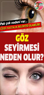 Goz Segirmesi Neden Olur Goz Segirmesi Nasil Gecer Goz Seyirme Hastalik All Things Beauty Beauty Hacks Beauty