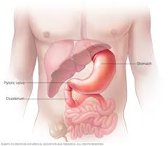 Gastroparesia Sintomas Y Causas Mayo Clinic