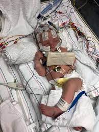 Intaction Org On Twitter Heartbreaking Mother S Pain Over Death Of Son After Circumcision Https T Co 7hkto61zgr Circumcisionkills I2 Foreskin Genitalcutting Pain Infant Babies Newborns Malegenitalmutilation Ameracadpeds Forsythmedcntr