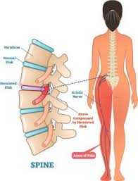 Akan tetapi, kemampuan ini dapat menurun dari waktu ke waktu, baik karena usia, kecelakaan, maupun kondisi kesehatan. Tanda Tanda Saraf Kejepit