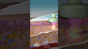 Lamerson is certified by the american board of dermatology. Reno Nv Facial Skin Tightening Carson City Minimally Invasive Tightening