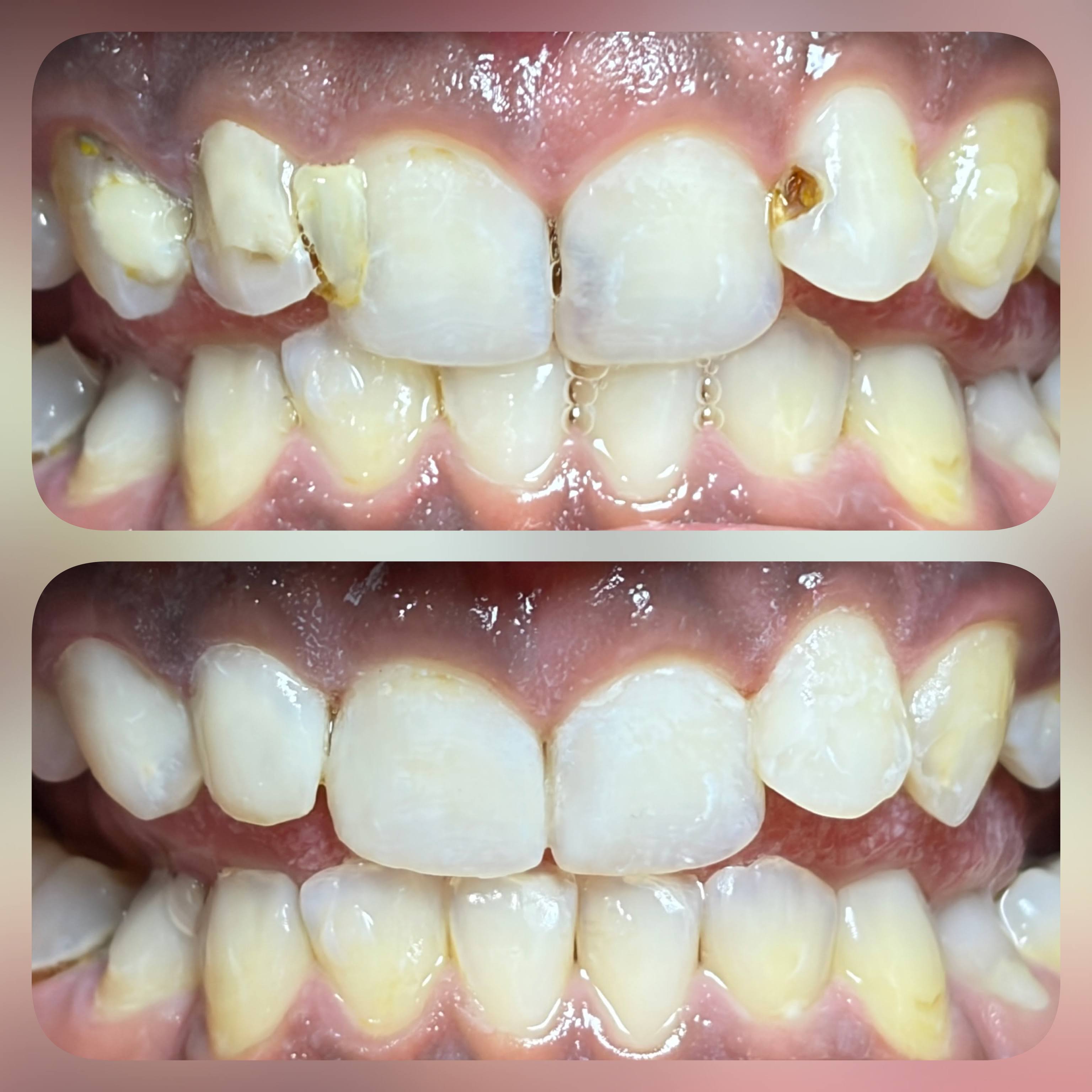 smile design product image