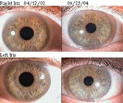 About Rayid Iridology Understanding Human Behavior