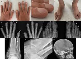 Image result for Digital Clubbing