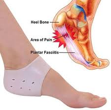 Pin On Joint Pain