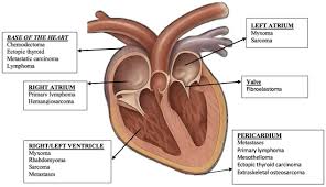 Image result for Chemodectoma