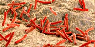 A scurfy, mealy substance on the surface of some plants. Lepra Focus Arztsuche