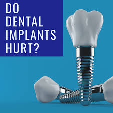 Usually the gums are red and swollen around an implant when this happens, but not always. Do Dental Implants Hurt Chicago Dental Implants