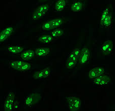 Image result for ANA Staining Pattern