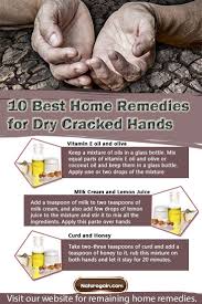 10 Best Home Remedies For Dry Cracked Hands That Work Dry Cracked Hands Dry Cracked Hands Remedy Cracked Hands