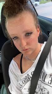 Hello everyone, do OCD patients get recovered completely ? Is there any  such case ?If so how much time does it takes to recover ?