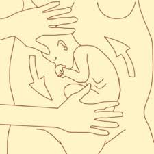 Image result for External Cephalic Version