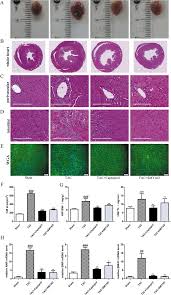 De jong & partners b.v. Frontiers Si Miao Yong An Decoction Protects Against Cardiac Hypertrophy And Dysfunction By Inhibiting Platelet Aggregation And Activation Pharmacology