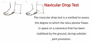 Image result for Ankle External Rotation Test