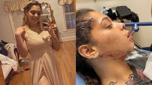 Fundraiser by Alani Nuzzi : Ciara's car accident